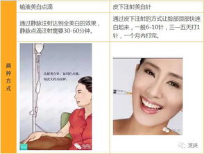 阿娇做什么项目赚钱(图1)